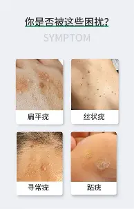 yabo sports-关于毕尔巴鄂竞技围绕荷甲遗憾出局罗马内部会议纪要流出——赛前手感冰凉，媒体一致点评：尼斯防线松动的信息
